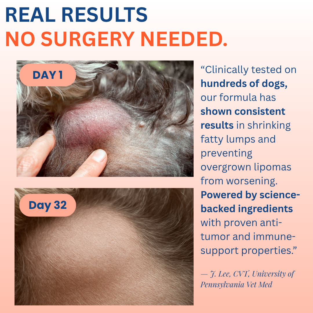 Lipoma Clear Probiotic™